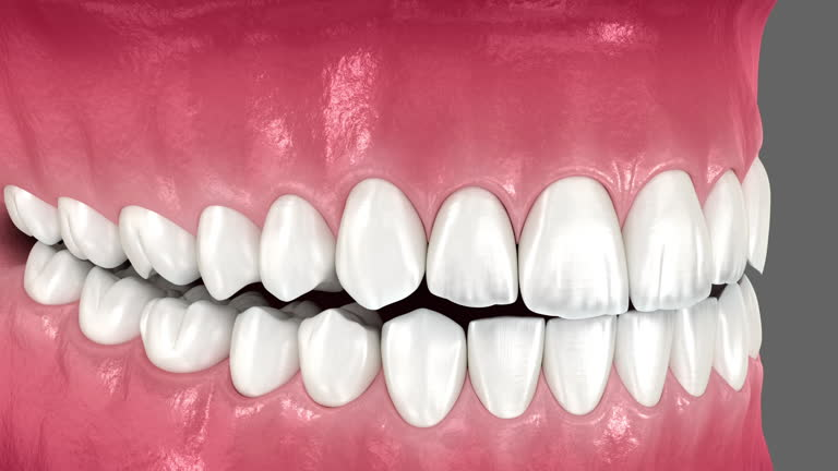 How to Compare Dental Implant Providers Before Making a Decision